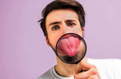Dry and white tongue of bad breath signs